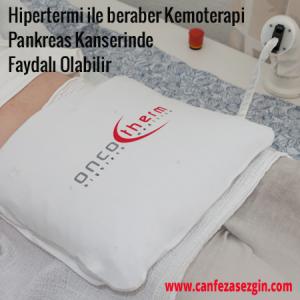 Hipertermi ile Beraber Kemoterapi Pankreas Kanserinde Faydalı Olabilir