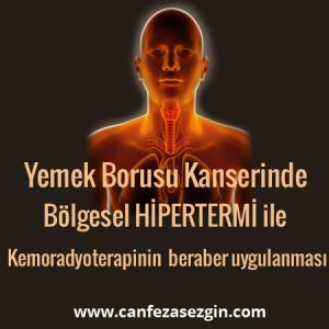 Yemek Borusu Kanserinde Bölgesel Hipertermi ile Kemoradyoterapinin Beraber Uygulanması