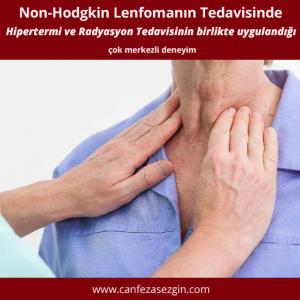 Non-Hodgkin Lenfomanın Tedavisinde Hipertermi ve Radyasyon Tedavisinin Birlikte Uygulandığı Çok Merkezli Deneyim