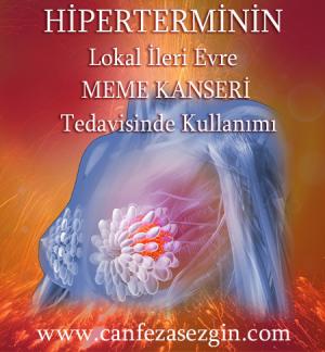 Hiperterminin Lokal İleri Evre Meme Kanseri Tedavisinde Kullanımı