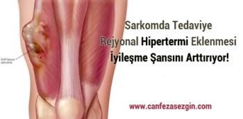 Sarkomda Tedaviye Rejyonal Hipertermi Eklenmesi İyileşme Şansını Arttırıyor