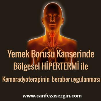 Yemek Borusu Kanserinde Bölgesel Hipertermi ile Kemoradyoterapinin Beraber Uygulanması