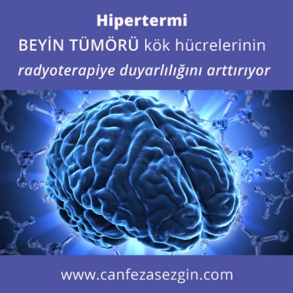 Hipertermi Beyin Tümörü Kök Hücrelerinin Radyoterapiye Duyarlılığını Arttırıyor